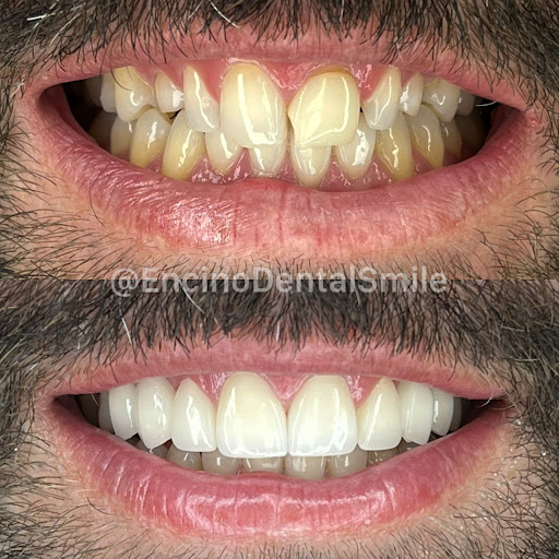 Encino Dental Smile image
