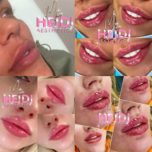 Dream Beauty Aesthetics - Dream Beauty Aesthetics