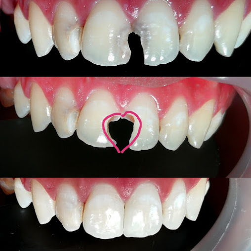 عيادة جودن لطب الأسنان - Goden Dental Clinic