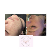 I-DealBeauty Kansas City - Photo 6 - Car repair in Kansas City, MO, Kansas City