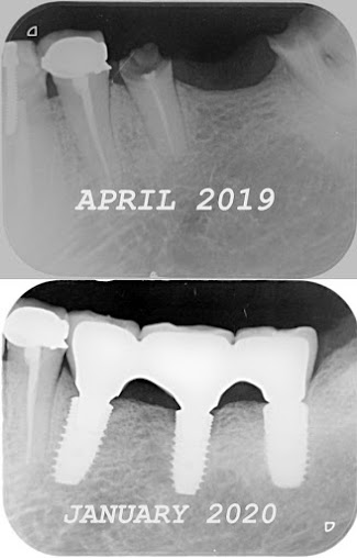 Dr Joglekars Dental Solutions - Dr Joglekars Dental Solutions