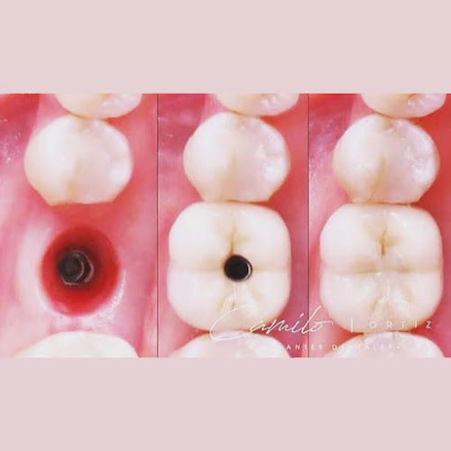 Camilo Ortiz Implantes Dentales - Manta