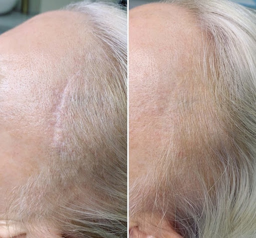 Explore firefly tattoo ideas, creative tattoo ideas in Santa Cruz, available at Luca Permanent Cosmetics