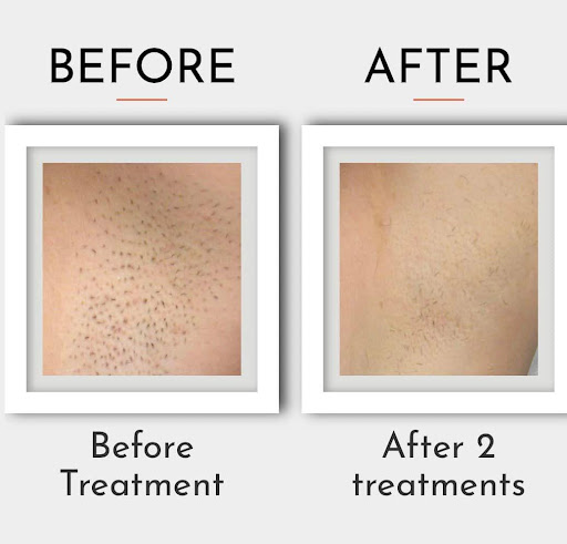 Explore tattoo ideas with crosses, creative tattoo ideas in Lake Dallas, available at Restore YOUth Med Spa