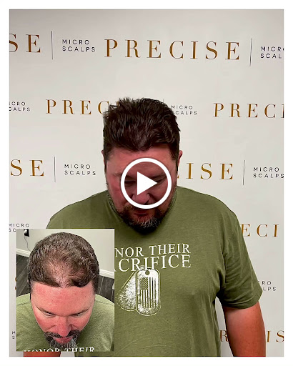 Precise Scalp Micro - Scalp Micropigmentation Service and Training image