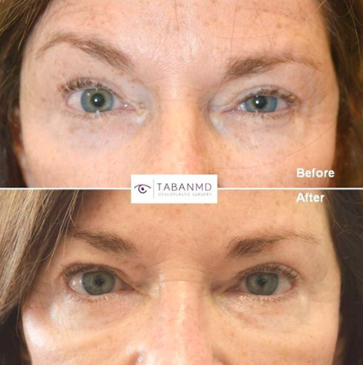 Mehryar Ray Taban MD - Oculoplastic Surgeon image