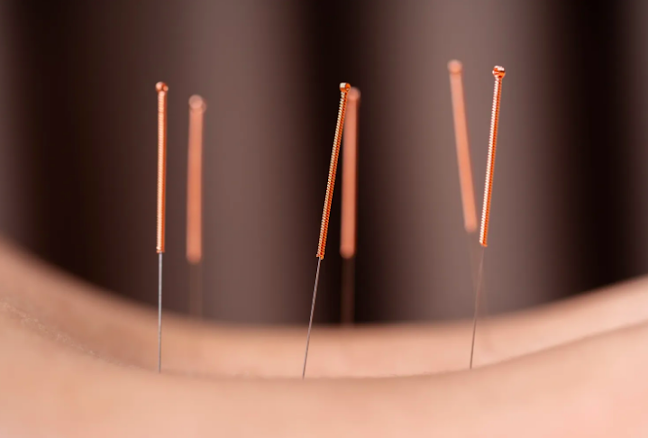 Deeper Well Acupuncture
