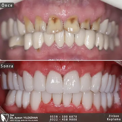 Diş Hekimi Dt. Aysun YILDIZHAN Ağız ve Diş Sağlığı Kliniği