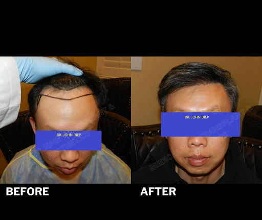 Medical Hair Transplant & Aesthetics image
