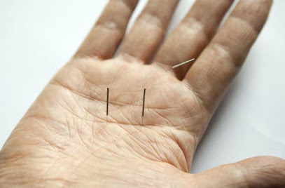 Acupuncture 5 Mouvements - Bourges Frederic acupuncteur à Terrebonne