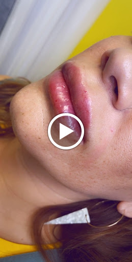 Lifted Beauty Medical Practice image