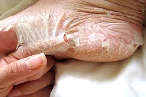 Saranya Skin Care Clinic (skin Doctor/Hospital/treatment in Tindivanam) image