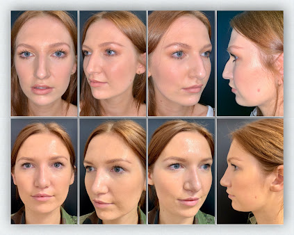 Afshin Yousefpour جراح تجميل الوجه - Afshin Yousefpour Facial Plastic Surgeon