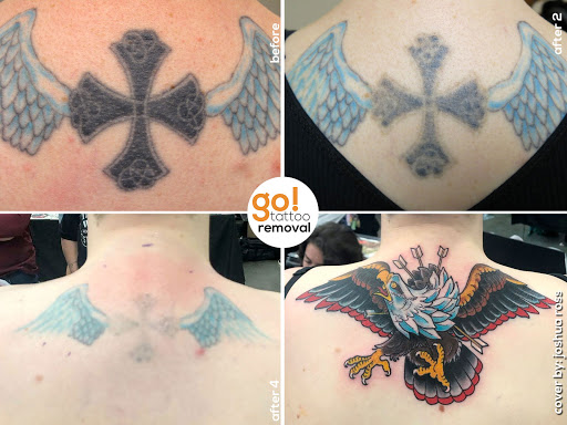 Explore black and white flower tattoo ideas, creative tattoo ideas in Allentown, available at Removery Tattoo Removal & Fading