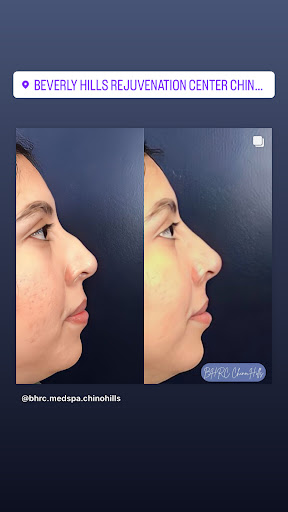 Beverly Hills Rejuvenation Center image