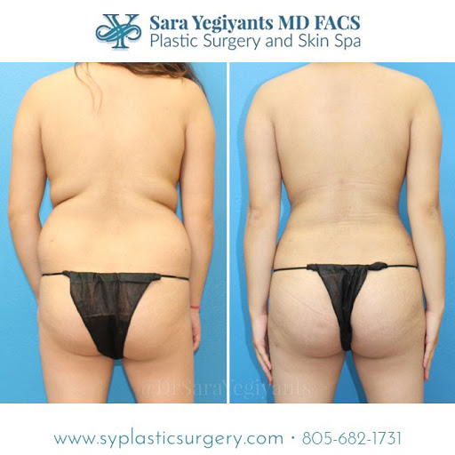 Sara Yegiyants MD FACS image