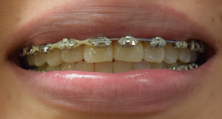 Pagosa Smiles FASTBRACES & Dentistry