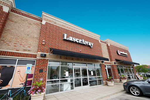 Explore cute girly tattoo ideas, creative tattoo ideas in Northbrook, available at LaserAway