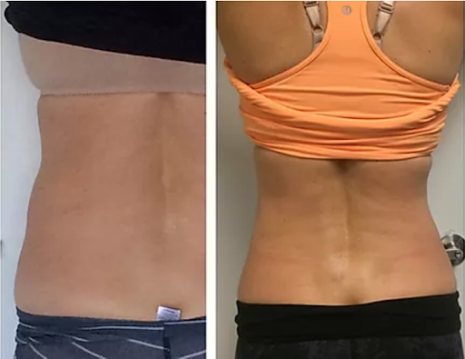 Human Optimization Center HOC Back Pain, Body Sculpting, Neck Pain, Knee Pain, Hip Pain, Joint Pain, Body Contouring image