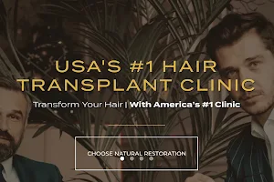 New Jersey Hair Transplant | Nova Medical image