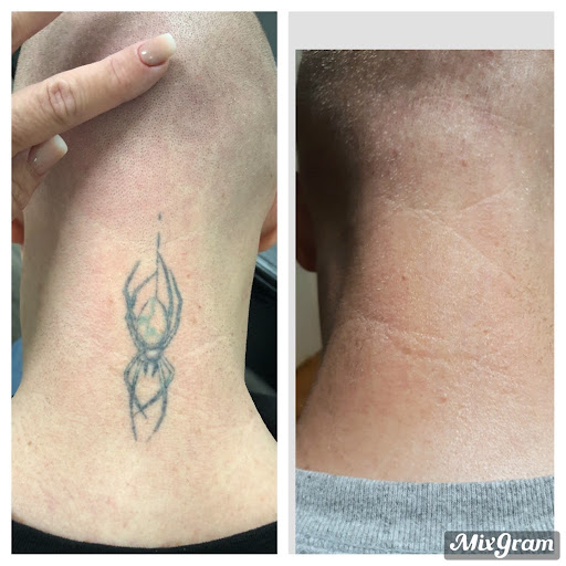 Explore tattoo ideas for capricorn, creative tattoo ideas in Longview, available at Vanish Laser Aesthetics