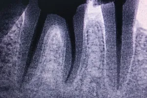 Prajapati dental care image