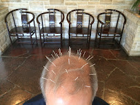 Yu Family Acupuncture Clinic - Photo 5 - Car repair in Los Angeles, CA, Los Angeles