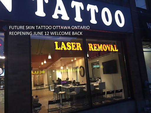 Tattoo removal service Ottawa