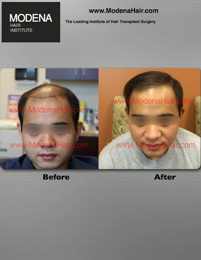Modena Hair Transplant Institute image