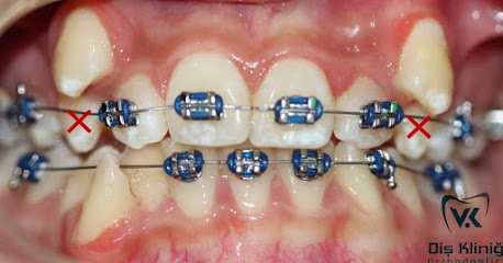 Uzman Diş Hekimi Dr. Veli KIFIL (Ortodontist)