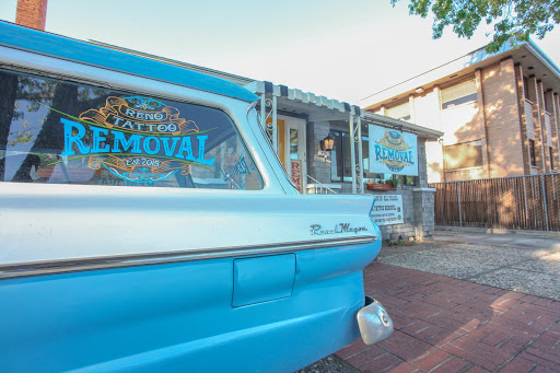 Explore boxer dog tattoo ideas, creative tattoo ideas in Reno, available at Reno Tattoo Removal