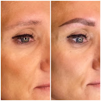 SoCal Electrolysis and Beauty Services