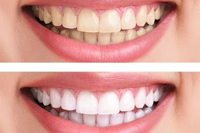 Smiles Dental Aurora by Dr Shasha