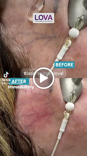 Explore tattoo on buttock ideas, creative tattoo ideas in Lake Oswego, available at Lake Oswego Vein and Aesthetic LOVA