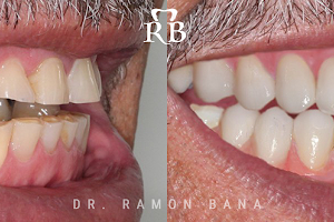 Ramon Bana, DDS - Miami Sedation & Cosmetic Dentistry image