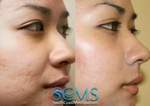 South Coast MedSpa image