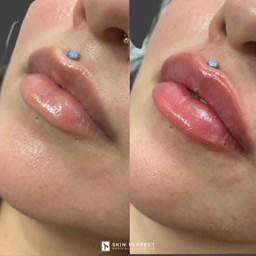 Explore is a neck tattoo a bad idea, creative tattoo ideas in Whittier, available at Skin Perfect Medical Aesthetics