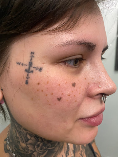 Explore kiss lip tattoo ideas, creative tattoo ideas in Lake Jackson, available at Second Chance Laser Tattoo Removal