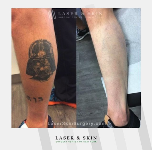 Explore persephone tattoo ideas, creative tattoo ideas in New York, available at Laser & Skin Surgery Center