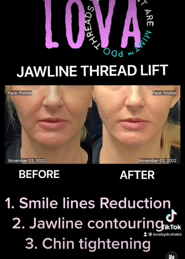 Explore tow truck tattoo ideas, creative tattoo ideas in Lake Oswego, available at Lake Oswego Vein and Aesthetic LOVA