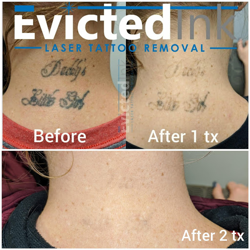 Explore clock hand tattoo ideas, creative tattoo ideas in Wichita, available at Evicted Ink Laser Tattoo Removal