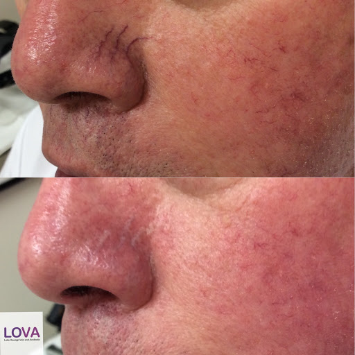 Explore tattoo ideas for men neck, creative tattoo ideas in Lake Oswego, available at Lake Oswego Vein and Aesthetic LOVA