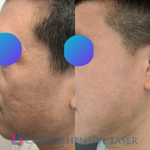 Explore triquetra tattoo ideas, creative tattoo ideas in Columbia, available at Comprehensive Laser & Aesthetics