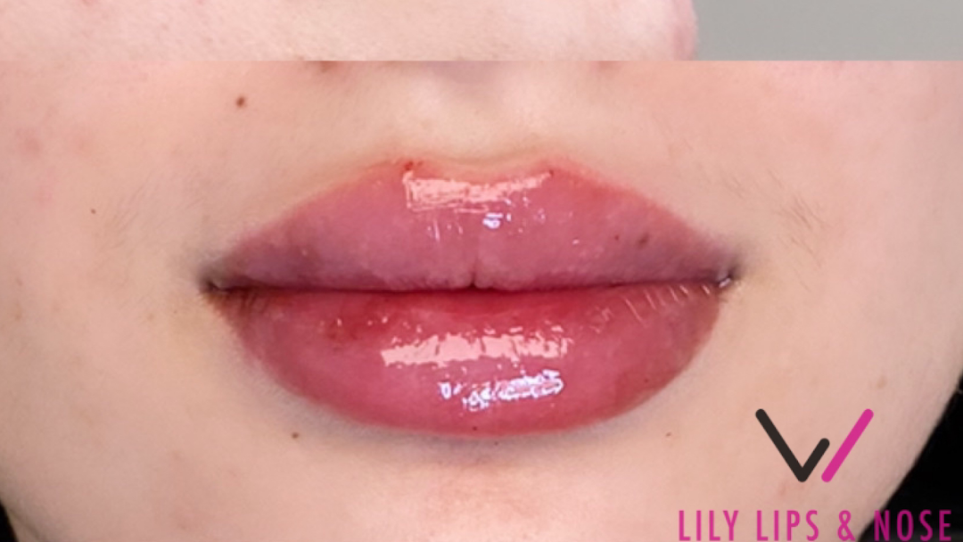 Lily Lips & Nose