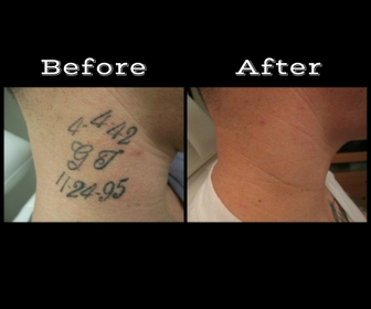 Explore night sky tattoo ideas, creative tattoo ideas in Longview, available at Vanish Laser Aesthetics