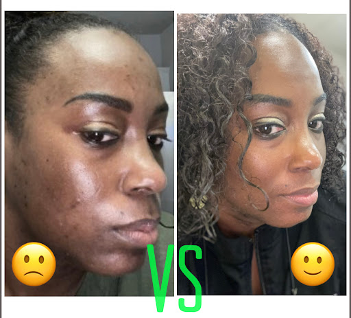 Explore tattoo ideas for pisces, creative tattoo ideas in Des Moines, available at Bare Beaute Permanent Hair Removal By Electrolysis, LLC