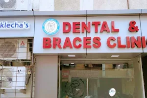 Saklecha's Dental Clinic | Dr. Bhuwan Saklecha | Best Orthodontist In Indore | Braces and Dental clinic image