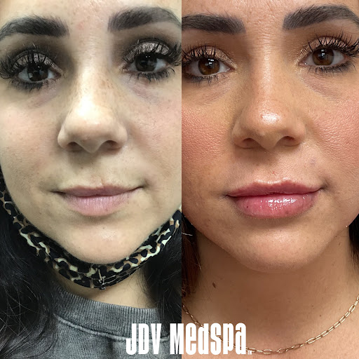 Explore killer klowns from outer space tattoo ideas, creative tattoo ideas in Canton, available at JDV Med Spa