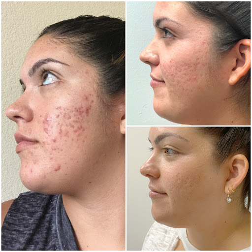 Skin Care Clinic «ZONA MED SPA», reviews and photos, 9767 N 91st St #102, Scottsdale, AZ 85258, USA