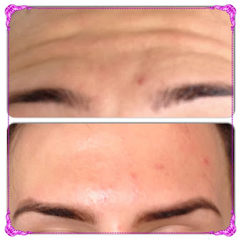 Tinkable Aesthetic Clinic Transformations - Tinkable Aesthetic Clinic Transformations